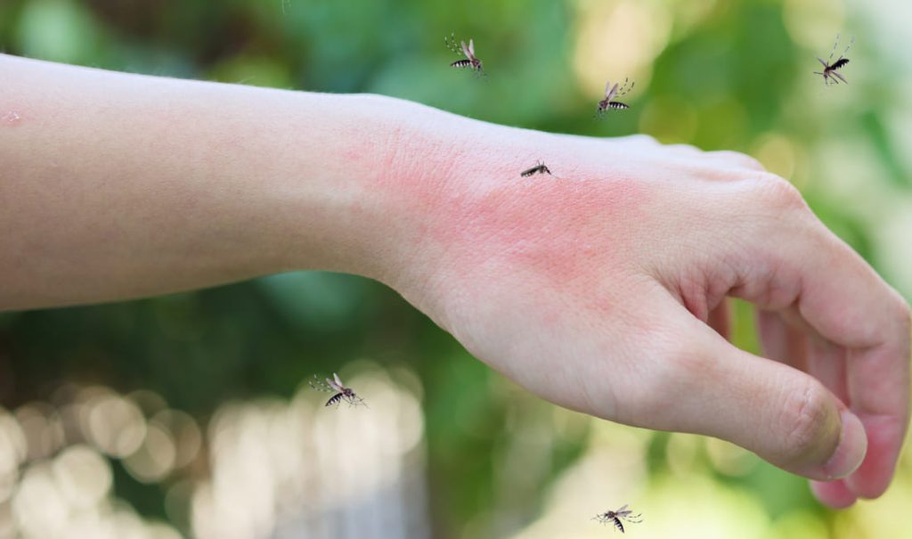 Insetti in giardino: come e quando fare la disinfestazione?