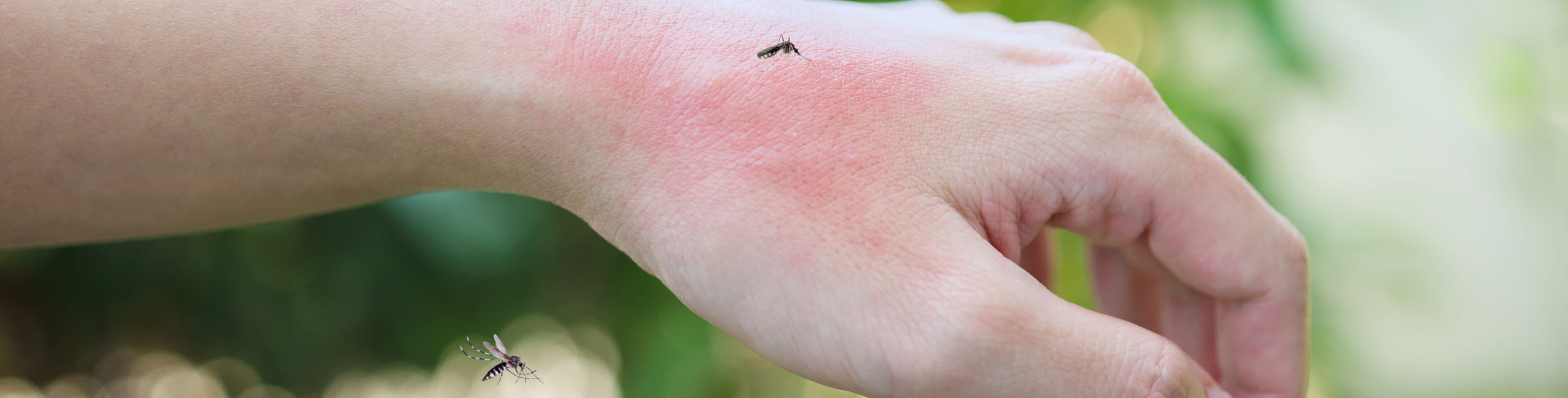 Insetti in giardino: come e quando fare la disinfestazione?